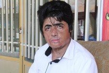 داستان آتش گرفتن صلاح الدین جوان از زبان خودش/آتشی که سال 86 جگر باینگانی ها را سوزاند/وقتی که روحانی هم کمکی نکرد