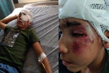 تا ساعتی دیگر، مانی نوجوان برای مداوا راهی تهران می شود