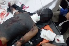 حادثه قطع عضو در اثر انفجار ترقه در روانسر