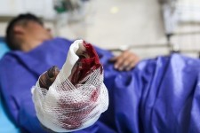 اولین حادثه چهارشنبه سوری در اورامانات