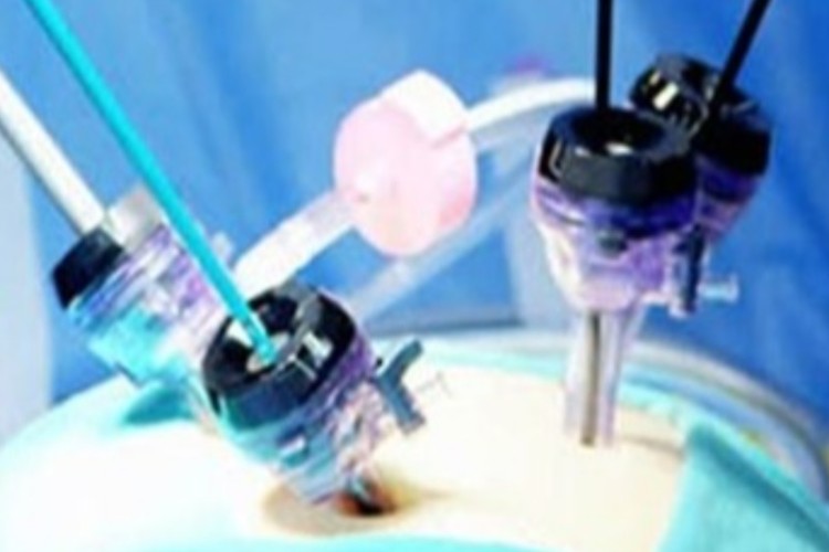 گزارش اقدام جهت تهیه لوازم جانبی و متعلقات پزشکی دستگاه لاپاراسکوب خریداری شده بیمارستان قدس پاوه