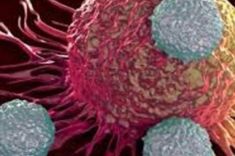 سرطان در مردان بیشتر از زنان است