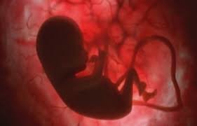 تشخیص درد کلیه به جای زایمان ومرگ نوزاد پاوه‌ای/توضیح دانشگاه علوم پزشکی درباره علت فوت جنین مادر پاوه‌ای