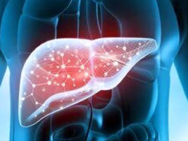 عوامل محیطی و ارثی بیماری‌های کبدی