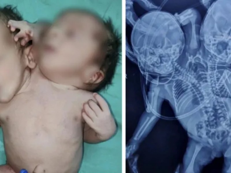 ممنوعیت سقط از ۴ ماهگی آری یا نه