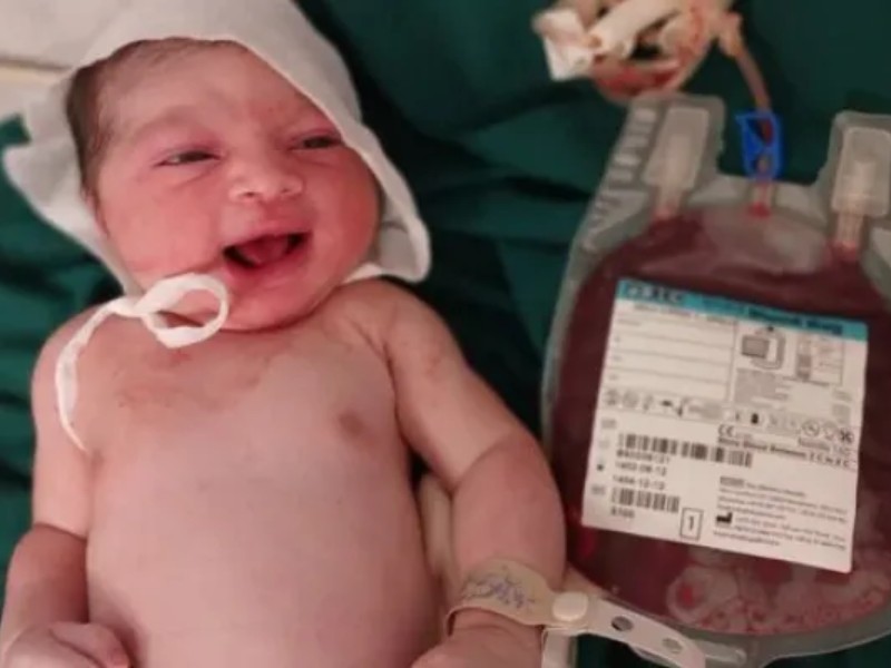 «خون بند ناف» ذخیره سلامت برای نوزاد