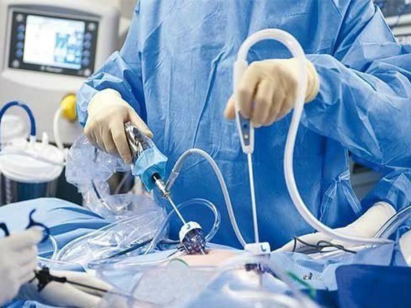 ازسرگیری انجام جراحی‌های لاپاراسکوپی در بیمارستان قدس پاوه